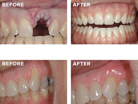 Periodontist in Tampa .